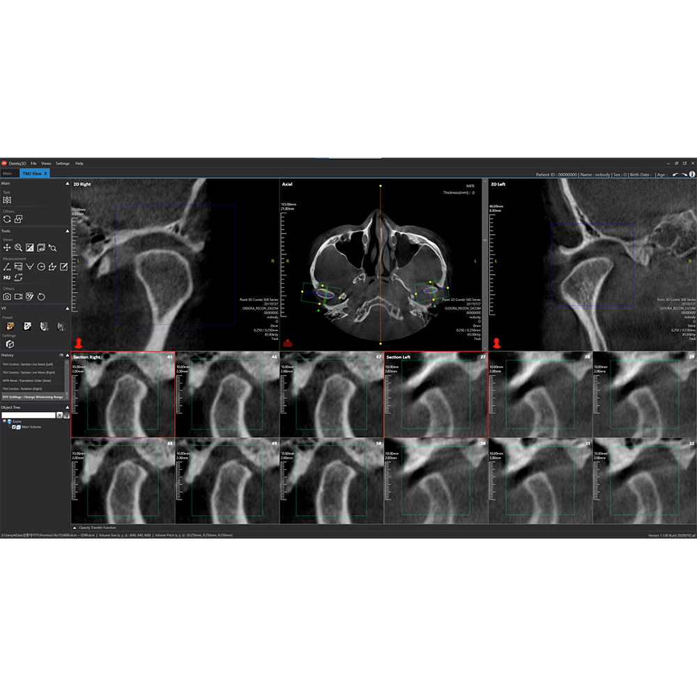 [3D Industrial] Dentiq3D